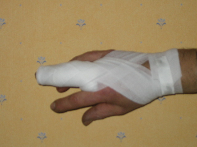 img71/3839/img1852tq3.jpg